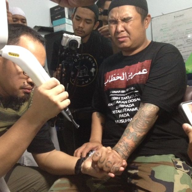 Meski Mahal, Kini Menghapus Tato Bisa Gratisan, Ditebus dengan Hafalan Alquran