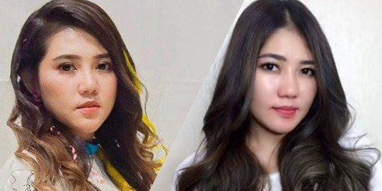 Tangannya Bersimbah Darah, Via Vallen Lansung Jadi Perbincangan