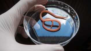 Pilu Balita di Sukabumi Meninggal, Ini Bahaya Cacingan yang Kerap Dianggap Sepele