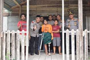 Kapolres Inhu Realisasikan Janji, Berikan Kaki Palsu pada Korban Lakalantas, Julita