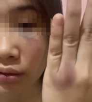 Curhat Dianiya Mantan Pacar, Polisi: Motif Cemburu