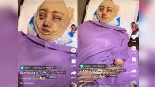 Lucinta Luna Belum Bisa Banyak Bicara, Mohon Doa Operasi Tahap Terakhir