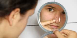 Ini Lima Bahan Alami yang Bisa Membantu Menghilangkan Bekas Jerawat dari Wajah