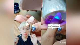 Kuku Penyintas Covid-19 Menyala di Bawah Sinar UV, Kenapa?