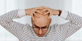 Kebotakan Bisa Terjadi di Usia Mudah dan Bahkan Dialami Wanita