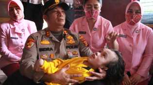 Sambangi Anak Penderita Hidrosefalus, Kapolres Bengkalis Gendong Alfandi Cek Kesehatan di RSUD
